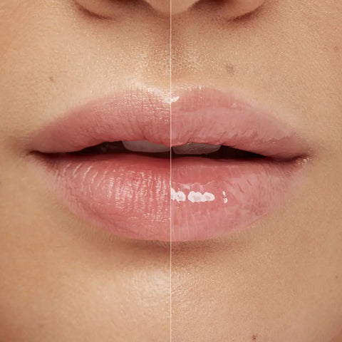 lip volume